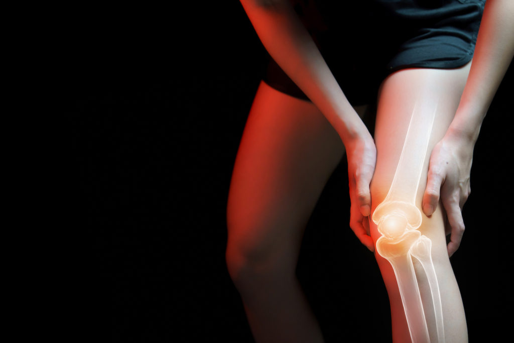 Knee SFP