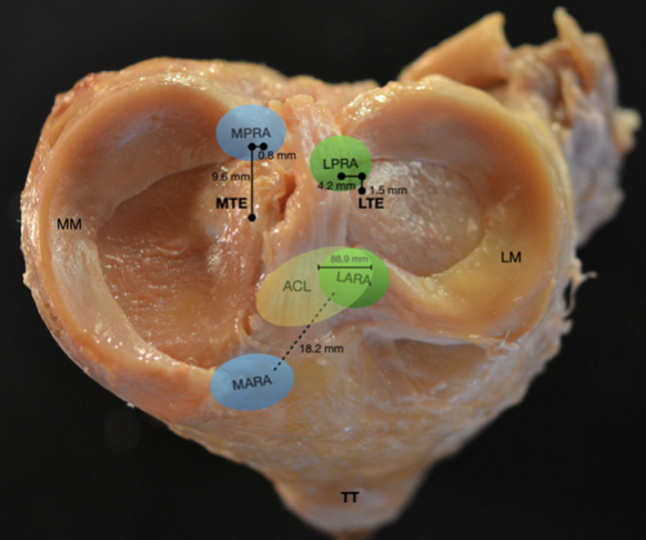 MARA, medial anterior root attachment; LARA, lateral anterior root attachment; MPRA, medial posterior root attachment; LPRA, lateral posterior root attachment; MM, medial meniscus; LM, lateral meniscus; MTE, medial tibial eminence; LTE, lateral tibial eminence; ACL, anterior cruciate ligament; TT, tibial tuberosity